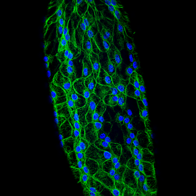19. Tubulin roads item