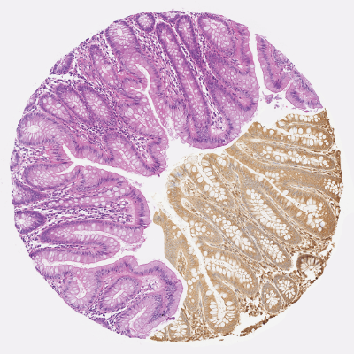 3. Corail intestinal item