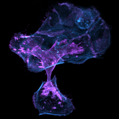 14. Microscopic Bonsai item