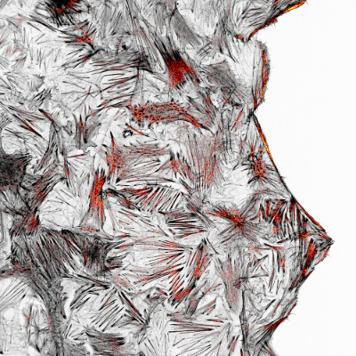 2. Contraction cellulaire item