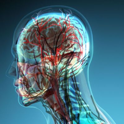 Neuro Healing 6 month program with equipment item