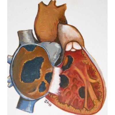 Alliance for Adult Research in Congenital Cardiology Inc.